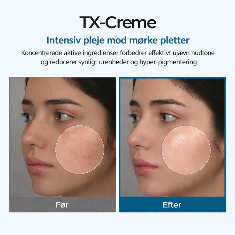 Dr. Melaxin – Pigment Correcting Cream | Reduser Mørke Flekker