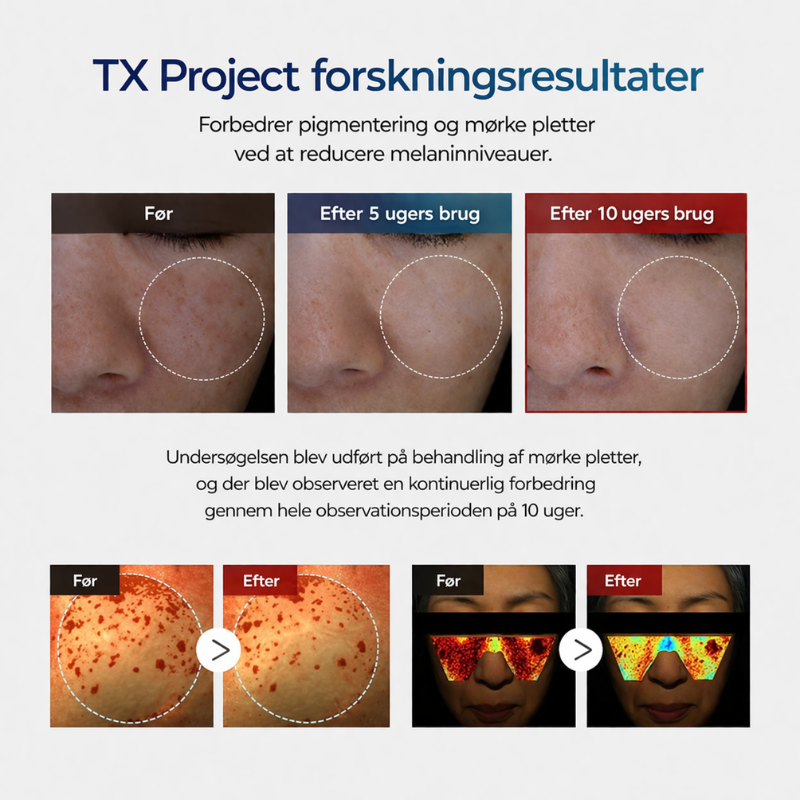 Dr. Melaxin – Pigment Correcting Cream | Reduser Mørke Flekker
