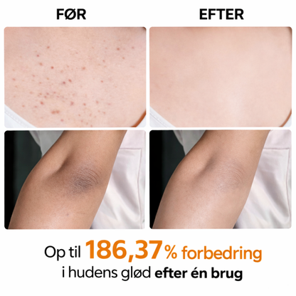 Dr. Melaxin – Body Peeling Spray | Glatt og fornyet hud