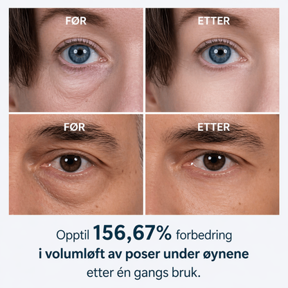 Dr. Melaxin – Eye Lift Cream | Reduser Mørke Flekker