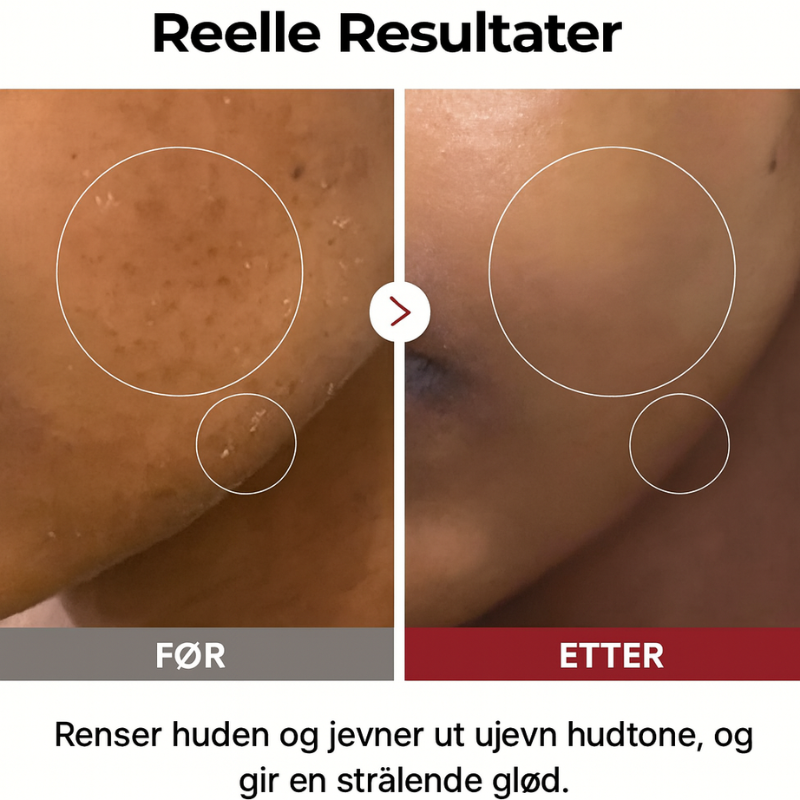 Dr. Melaxin – Rice Peel Shot Duo | Glød & Hudstruktur