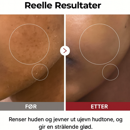 Dr. Melaxin – Rice Peel Shot Duo | Glød & Hudstruktur