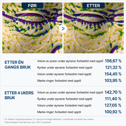 Dr. Melaxin – Eye Lift Cream | Reduser Mørke Flekker